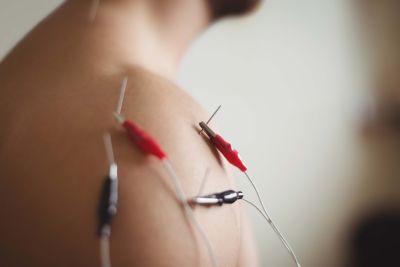 Island Acupuncture &amp; Massage photo