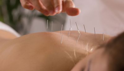 Island Acupuncture &amp; Massage photo
