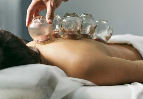 Island Acupuncture & Massage, Cupping